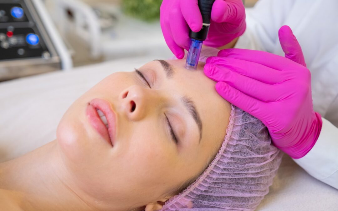 woman receives microneedling treatment