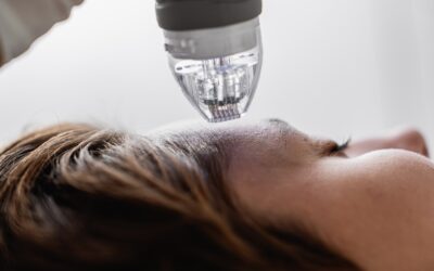 Discover Scarlet SRF: Revolutionize Your Skin Tightening Routine